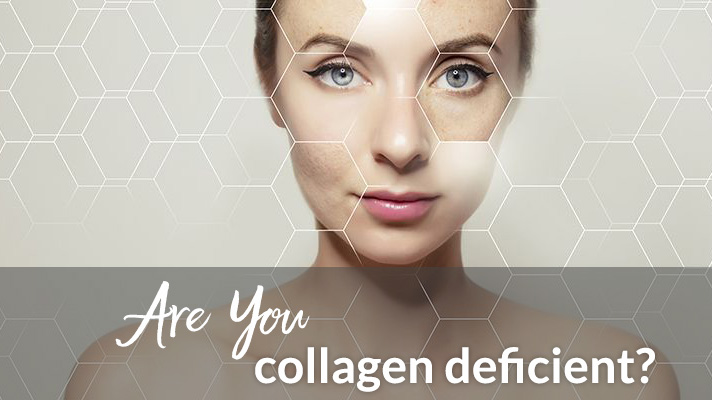 Collagen Deficiency